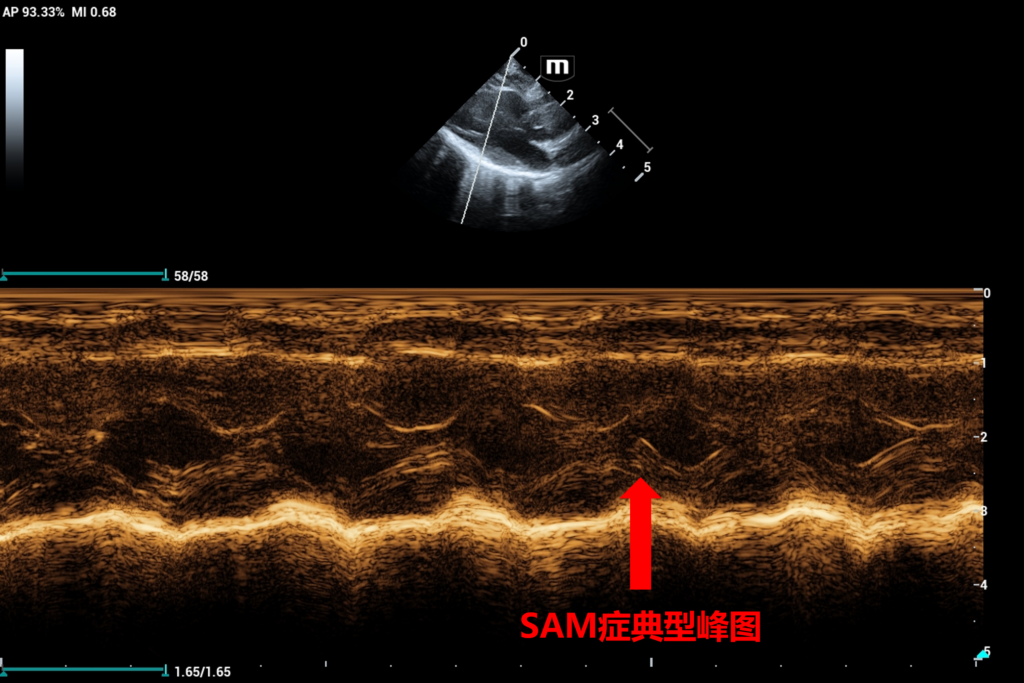 模型猫的多巴酚丁胺挑战心动超声图(M Mode,数据来自以济生物)